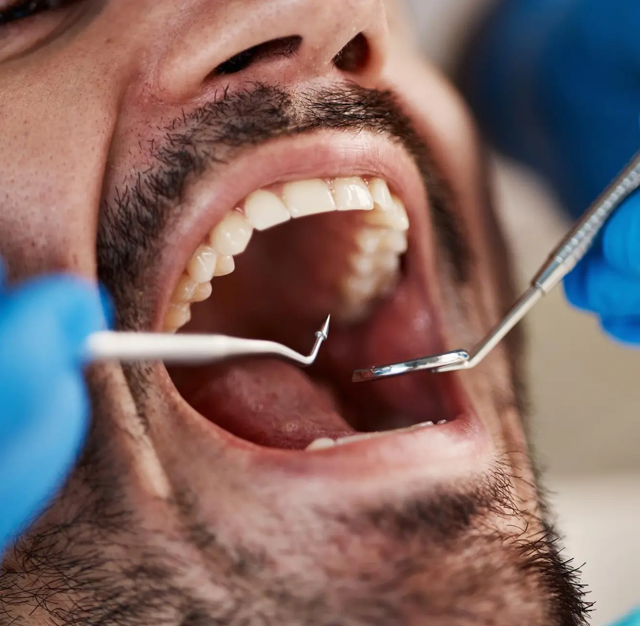 Periodoncia en palma