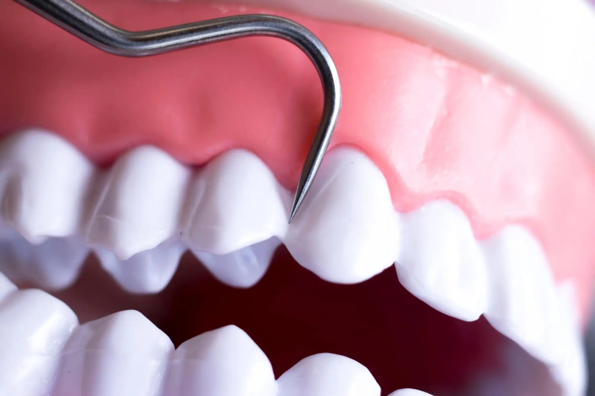 Periodoncia en palma